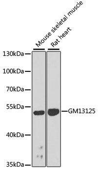 Western blot - Gm13125 Polyclonal Antibody 