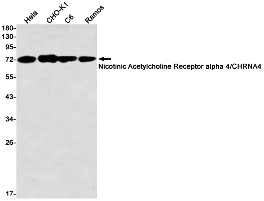 Western blot detection of Nicotinic Acetylcholine Receptor alpha 4/CHRNA4 in Hela,CHO-K1,C6,Ramos cell lysates using Nicotinic Acetylcholine Receptor alpha 4/CHRNA4 Rabbit mAb(1:1000 diluted).Predicted band size:70kDa.Observed band size:70kDa.