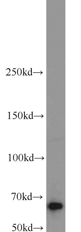 Jurkat cells were subjected to SDS PAGE followed by western blot with Catalog No:111679(IGF2BP1 antibody) at dilution of 1:1000