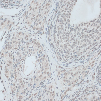 Immunohistochemistry - ZNF416 Polyclonal Antibody 