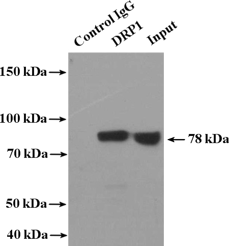 IP Result of anti-DNM1L,DLP1 (IP:Catalog No:110024, 4ug; Detection:Catalog No:110024 1:500) with mouse brain tissue lysate 3600ug.