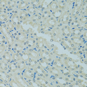 Immunohistochemistry - MBD2 Polyclonal Antibody 