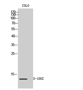 Fig1:; Western Blot analysis of COLO cells using S-100Z Polyclonal Antibody
