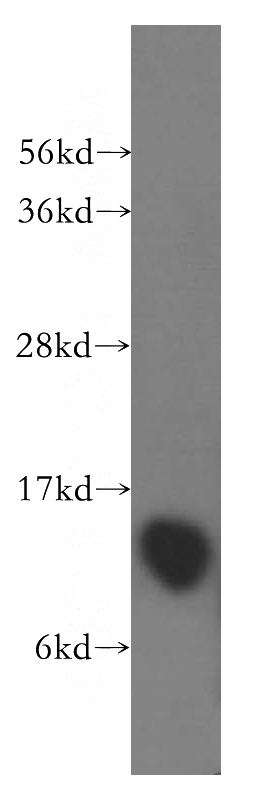 human brain tissue were subjected to SDS PAGE followed by western blot with Catalog No:110142(DYNLT1 antibody) at dilution of 1:500