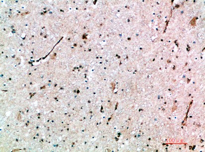 Fig1:; Immunohistochemical analysis of paraffin-embedded human-brain, antibody was diluted at 1:200