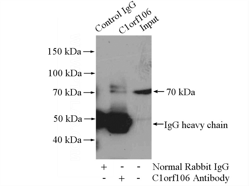 IP Result of anti-C1orf106 (IP:Catalog No:108631, 4ug; Detection:Catalog No:108631 1:500) with mouse kidney tissue lysate 4800ug.