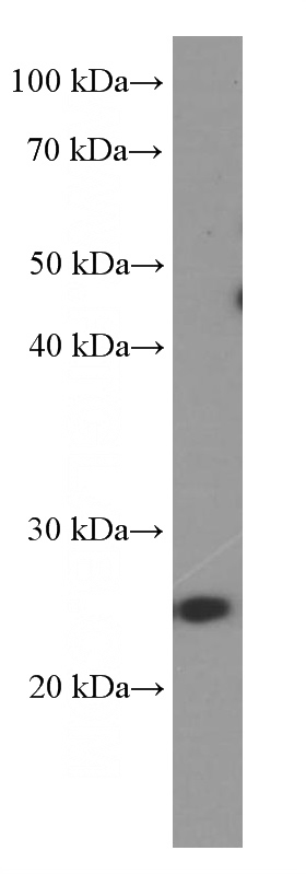 NCCIT cell were subjected to SDS PAGE followed by western blot with (LIN28 Antibody) at dilution of 1:1000