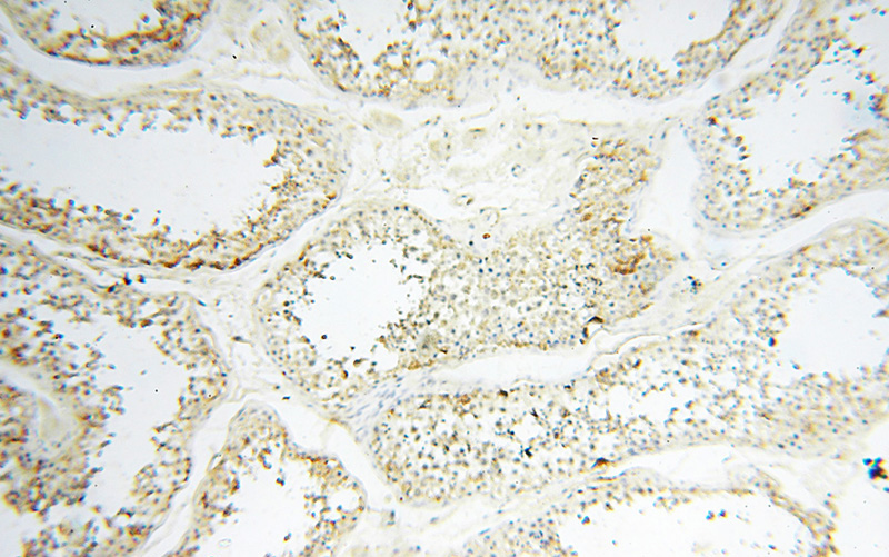 Immunohistochemical of paraffin-embedded human testis using Catalog No:110222(EHBP1 antibody) at dilution of 1:100 (under 10x lens)