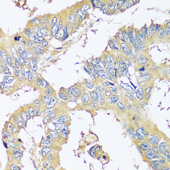 Immunohistochemistry - BLOC1S3 Polyclonal Antibody 