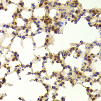 Immunohistochemistry - TAF1C Polyclonal Antibody 
