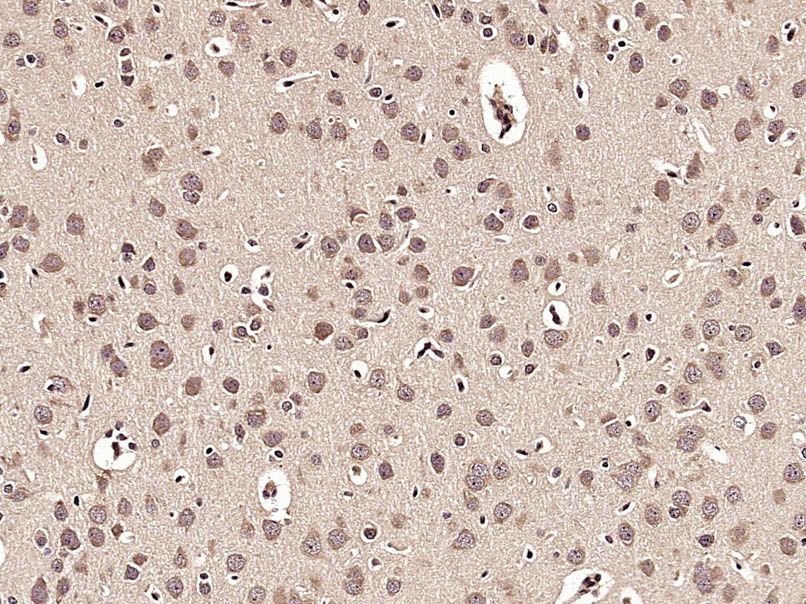 Fig5: Paraformaldehyde-fixed, paraffin embedded (Rat brain); Antigen retrieval by microwave in sodium citrate buffer (pH6.0) ; Block endogenous peroxidase by 3% hydrogen peroxide for 30 minutes; Blocking buffer (3% BSA) at RT for 30min; Antibody incubation with (TREM2) Polyclonal Antibody, Unconjugated at 1:400 overnight at 4℃, followed by conjugation to the secondary antibody (labeled with HRP)and DAB staining.