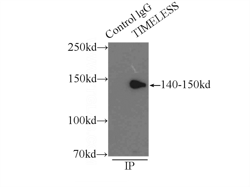 IP Result of anti-TIMELESS (IP:Catalog No:116128, 3ug; Detection:Catalog No:116128 1:1000) with mouse testis tissue lysate 10000ug.