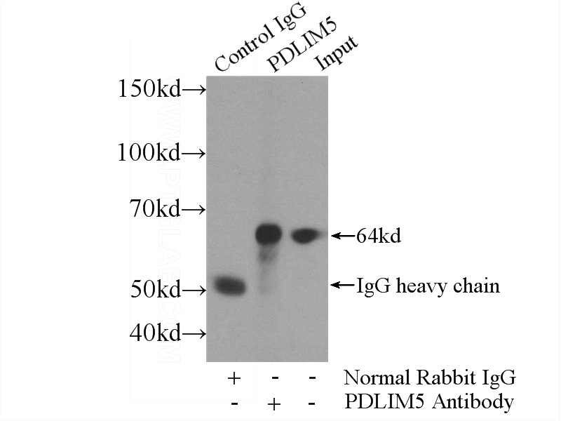 IP Result of anti-PDLIM5 (IP:Catalog No:113631, 4ug; Detection:Catalog No:113631 1:300) with A549 cells lysate 2400ug.