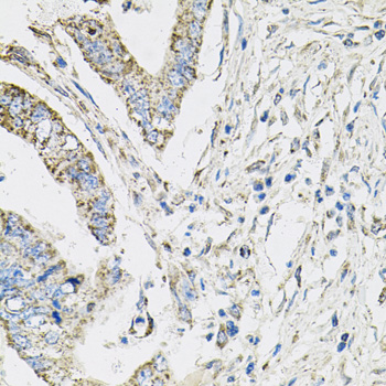 Immunohistochemistry - PI3 Kinase p110 beta Polyclonal Antibody 
