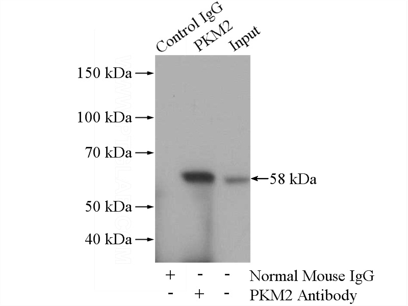 IP Result of anti-PK-M2-specific (IP:Catalog No:107474, 5ug; Detection:Catalog No:107474 1:300) with HeLa cells lysate 2800ug.
