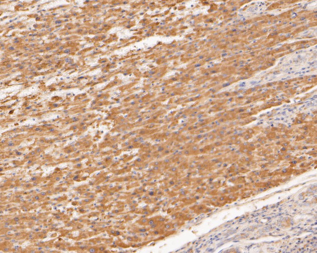 Fig2:; Immunohistochemical analysis of paraffin-embedded human liver tissue using anti-TREM2 antibody. The section was pre-treated using heat mediated antigen retrieval with Tris-EDTA buffer (pH 8.0-8.4) for 20 minutes.The tissues were blocked in 5% BSA for 30 minutes at room temperature, washed with ddH; 2; O and PBS, and then probed with the primary antibody ( 1/50) for 30 minutes at room temperature. The detection was performed using an HRP conjugated compact polymer system. DAB was used as the chromogen. Tissues were counterstained with hematoxylin and mounted with DPX.