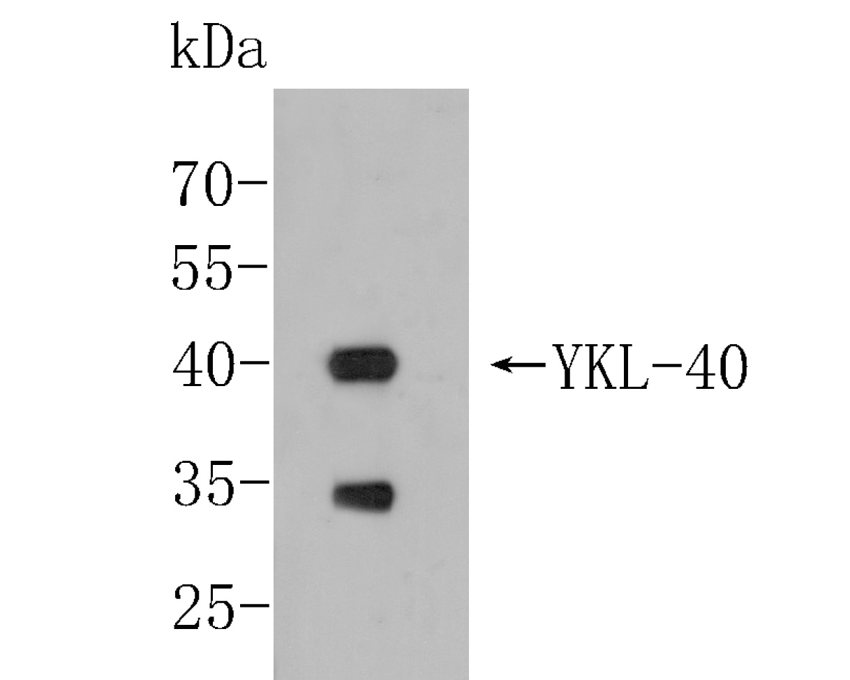 Fig1:; Western blot analysis of YKL-40/CHI3L1 on THP-1 cell lysates. Proteins were transferred to a PVDF membrane and blocked with 5% BSA in PBS for 1 hour at room temperature. The primary antibody ( 1/500) was used in 5% BSA at room temperature for 2 hours. Goat Anti-Mouse IgG - HRP Secondary Antibody (HA1006) at 1:5,000 dilution was used for 1 hour at room temperature.