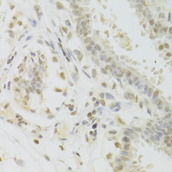 Immunohistochemistry - PRPF3 Polyclonal Antibody 