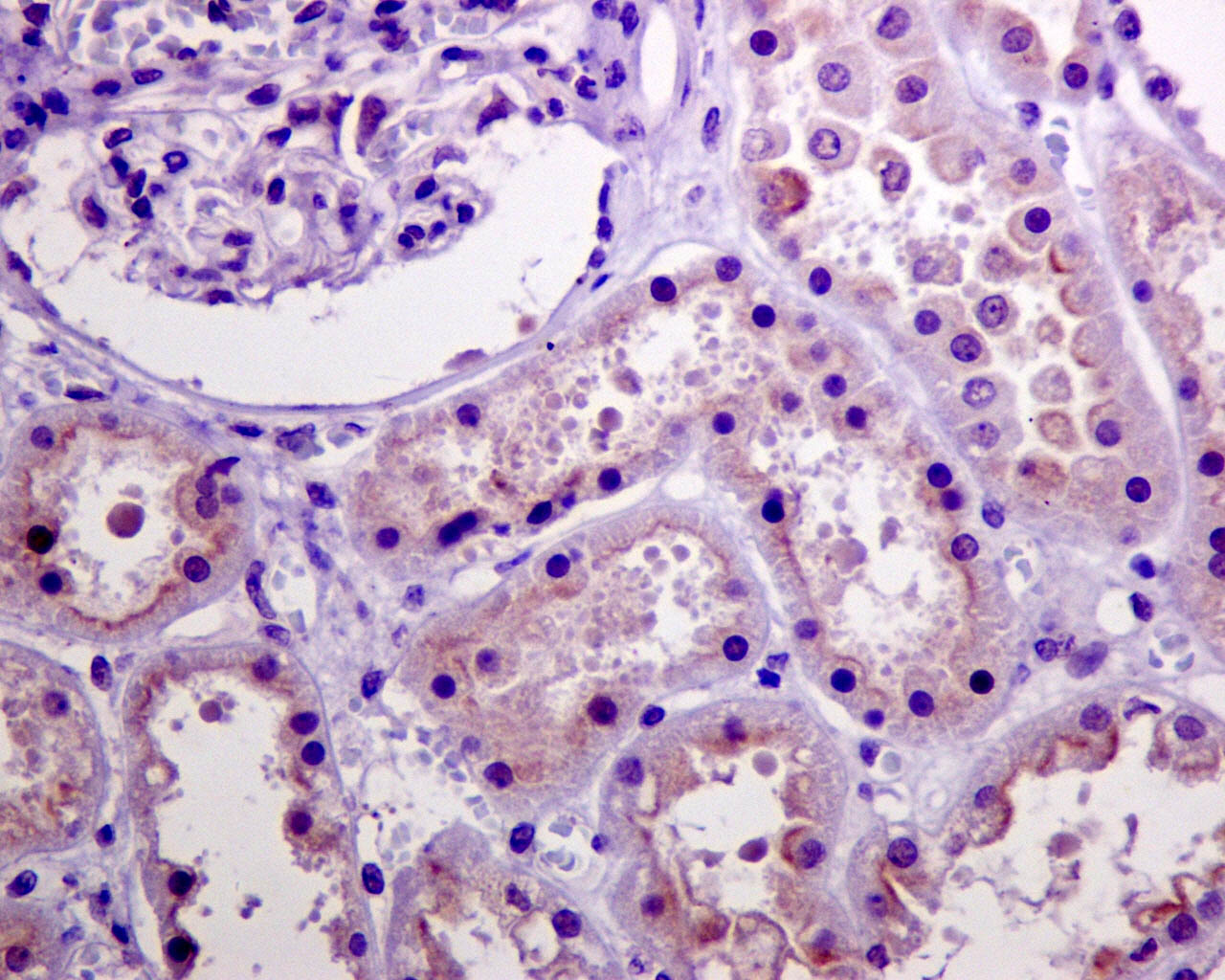 Immunohistochemical analysis of paraffin-embedded human kidney, using Phospho-Akt(Ser473) Antibody.