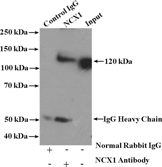 IP Result of anti-SLC8A1 (IP:Catalog No:113049, 4ug; Detection:Catalog No:113049 1:1000) with mouse brain tissue lysate 4000ug.