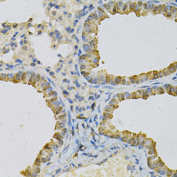 Immunohistochemistry - CDA Polyclonal Antibody 