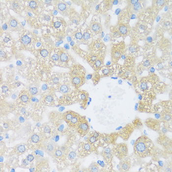 Immunohistochemistry - BRSK1 Polyclonal Antibody 
