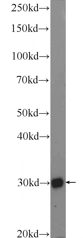 MCF-7 cells were subjected to SDS PAGE followed by western blot with Catalog No:117239(BRMS1 Antibody) at dilution of 1:600