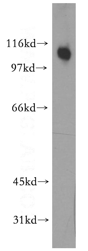 human heart tissue were subjected to SDS PAGE followed by western blot with Catalog No:114150(PPP1R13L antibody) at dilution of 1:200