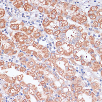 Immunohistochemistry - MBTPS1 Polyclonal Antibody 