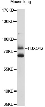 Western blot - FBXO42 Polyclonal Antibody 