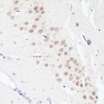 Immunohistochemistry - Bcl9 Polyclonal Antibody 