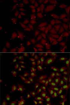 Immunofluorescence - CCL25 Polyclonal Antibody 