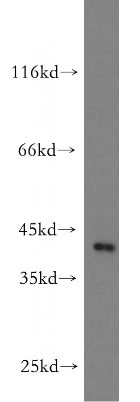 mouse brain tissue were subjected to SDS PAGE followed by western blot with Catalog No:112159(LAYN antibody) at dilution of 1:500