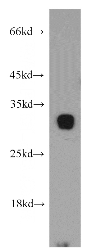 mouse pancreas tissue were subjected to SDS PAGE followed by western blot with Catalog No:116182(TMEM27 antibody) at dilution of 1:500
