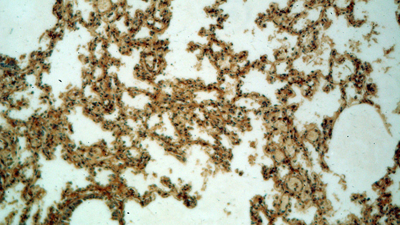 Immunohistochemical of paraffin-embedded human lung using Catalog No:109649(CXorf22 antibody) at dilution of 1:50 (under 10x lens)