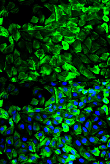 Immunofluorescence - TPM1 Polyclonal Antibody 