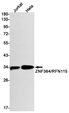 Western blot detection of ZNF364/RFN115 in Jurkat,Hela cell lysates using ZNF364/RFN115 Rabbit mAb(1:1000 diluted).Predicted band size:34kDa.Observed band size:34kDa.
