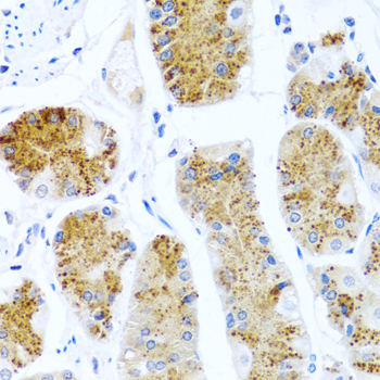 Immunohistochemistry - C8orf4 Polyclonal Antibody 