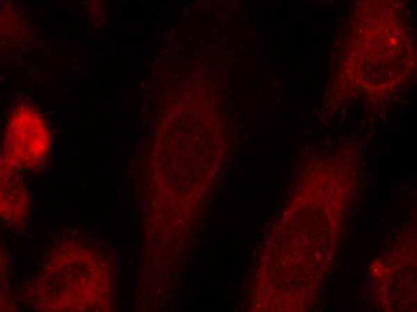 Immunofluorescence staining of methanol-fixed Hela cells using eIF2u03b1(Phospho-Ser51) Antibody .
