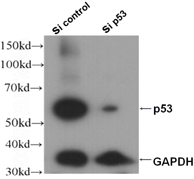 WB result of p53 antibody (Catalog No:116258, 1:1000) with sh-control and sh-p53 transfected A431 cells.