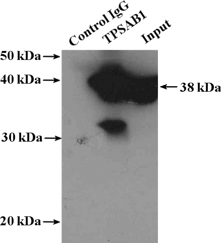 IP Result of anti-TPSAB1 (IP:Catalog No:116217, 4ug; Detection:Catalog No:116217 1:800) with mouse liver tissue lysate 4000ug.