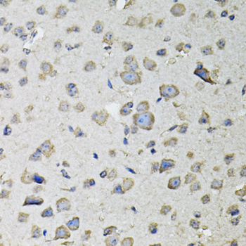 Immunohistochemistry - RASSF1 Polyclonal Antibody 