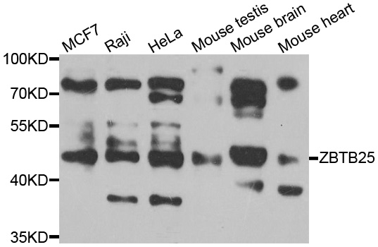 Western blot - ZBTB25 Polyclonal Antibody 