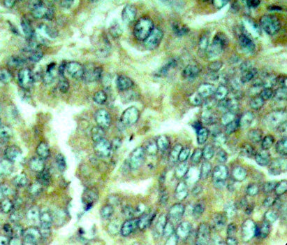 Immunohistochemistry - Phospho-DOK1-Y398 pAb 
