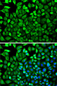 Immunofluorescence - CDA Polyclonal Antibody 