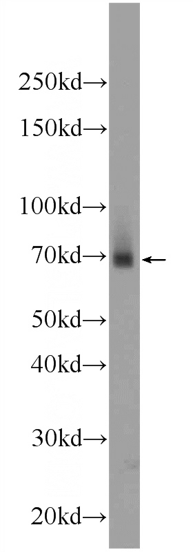 mouse small intestine tissue were subjected to SDS PAGE followed by western blot with Catalog No:117001(ZNF512 Antibody) at dilution of 1:600