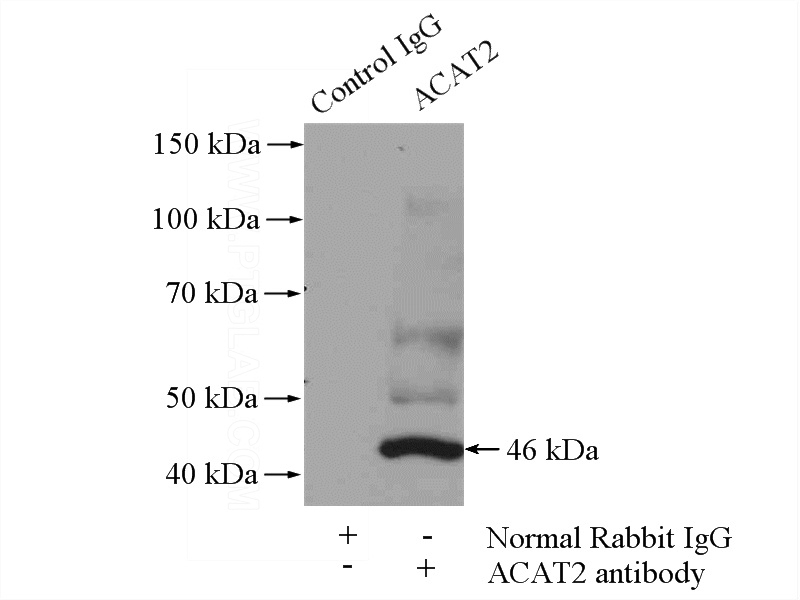 IP Result of anti-ACAT2 (IP:Catalog No:107728, 4ug; Detection:Catalog No:107728 1:1000) with mouse liver tissue lysate 4000ug.