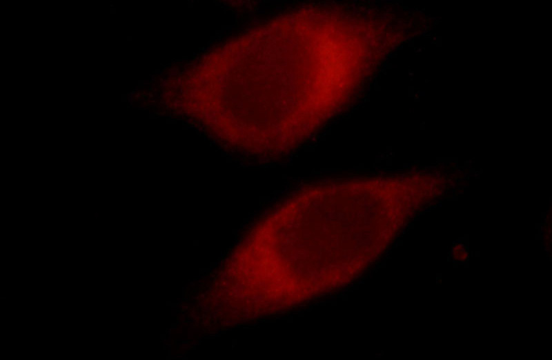 Immunofluorescent analysis of MCF-7 cells, using NOMO1 antibody Catalog No:113300 at 1:50 dilution and Rhodamine-labeled goat anti-rabbit IgG (red).
