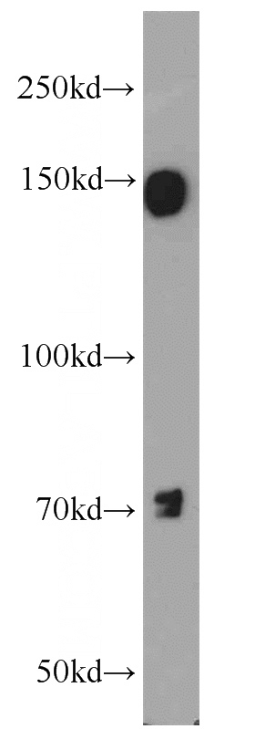 HeLa cells were subjected to SDS PAGE followed by western blot with Catalog No:110218(EGFR-Specific antibody) at dilution of 1:1000