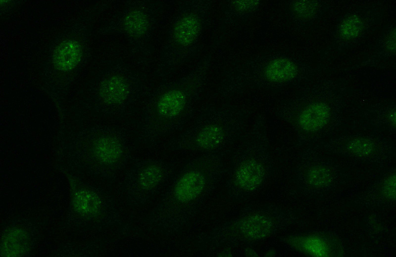 Immunofluorescent analysis of (-20oc Acetone) fixed SH-SY5Y cells using Catalog No:111892(JNK Antibody) at dilution of 1:50 and Alexa Fluor 488-congugated AffiniPure Goat Anti-Rabbit IgG(H+L)